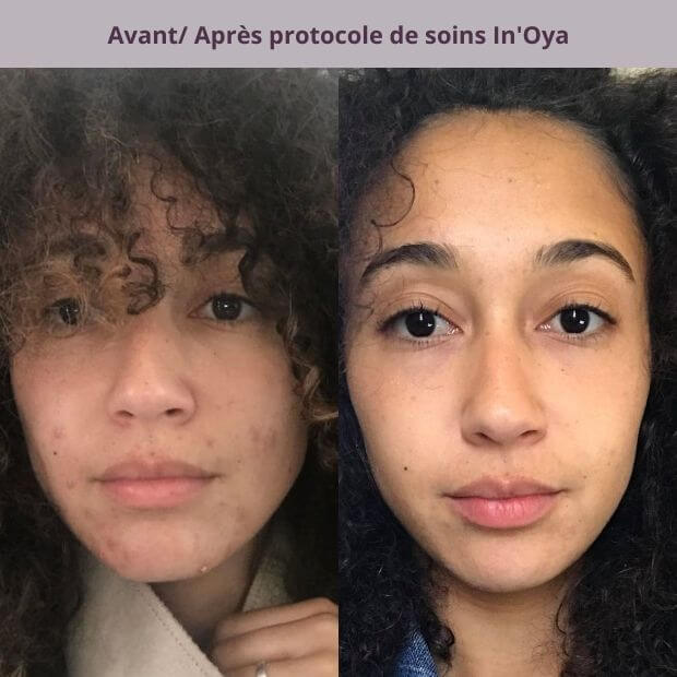 découvrez notre gamme de soins spécifiques pour les peaux noires, conçus pour nourrir, hydrater et sublimer votre visage. profitez de formules adaptées qui révèlent l'éclat naturel de votre peau tout en respectant ses besoins uniques.