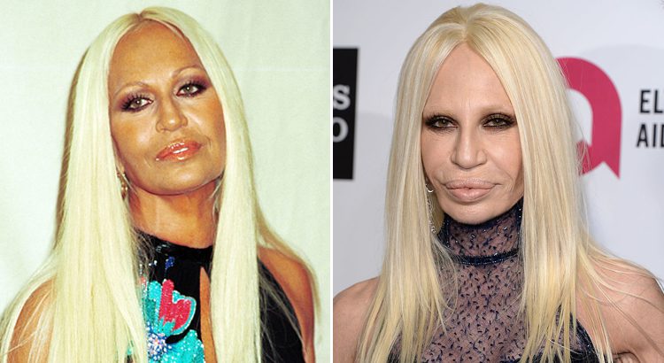 découvrez comment la chirurgie esthétique influence le monde des célébrités. explorez les transformations, les tendances et les avis de stars qui ont choisi de recourir à des interventions pour sublimer leur apparence. plongez dans l'univers fascinant de la beauté et des apparences où chaque choix est scruté par le public.