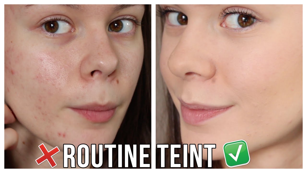 découvrez notre guide complet sur les fonds de teint adaptés aux peaux grasses. apprenez à choisir les produits qui contrôlent la brillance, minimisent les imperfections et offrent un fini mat longue durée. sublimez votre teint tout en garantissant un confort optimal!