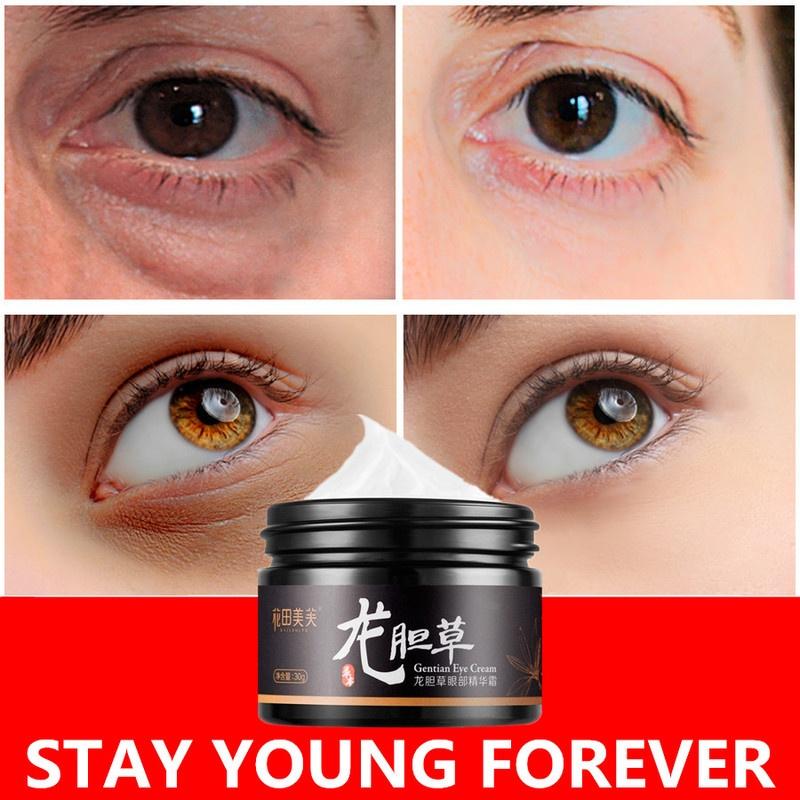 découvrez des astuces efficaces pour éliminer les cernes et retrouver un regard frais et lumineux. apprenez des méthodes naturelles et des soins adaptés pour atténuer les poches sous les yeux et raviver votre teint.