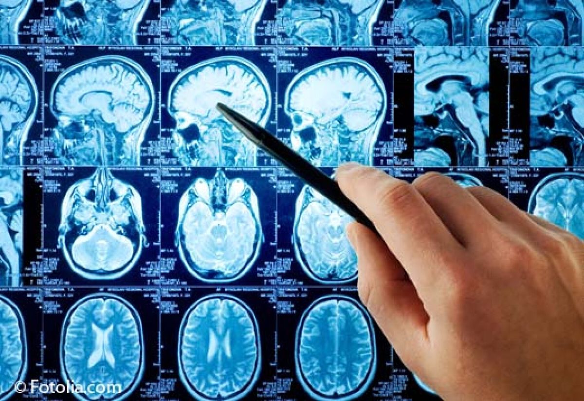 prenez votre rendez-vous pour une irm en toute simplicité. découvrez nos services d'imagerie médicale et bénéficiez d'un diagnostic précis et rapide, dans un cadre chaleureux et professionnel.