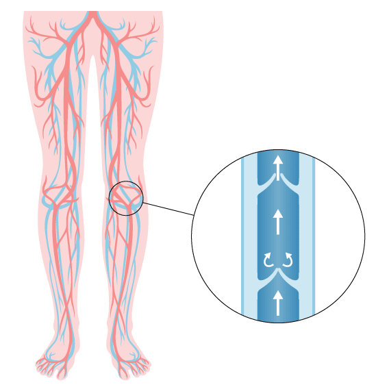 découvrez les principaux signes nécessitant une consultation chez un phlébologue : douleurs, varices, gonflements des jambes, lourdeurs ou troubles circulatoires. prévenez les complications veineuses grâce à un diagnostic précoce.