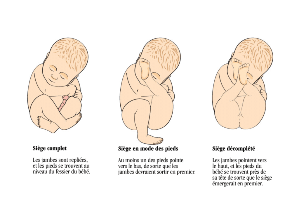 découvrez le sens spirituel des taches de naissance et leur lien avec le karma, pour mieux comprendre leur influence dans votre vie.