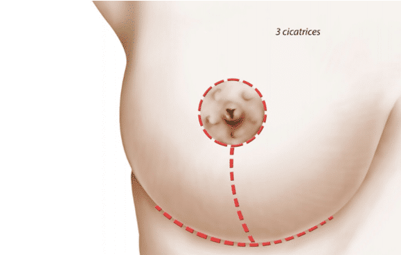 découvrez les conditions pour bénéficier d'un remboursement en chirurgie esthétique, les critères d'éligibilité et les démarches à suivre.